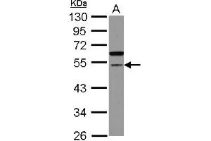 Western Blotting (WB) image for anti-Cell Division Cycle Associated 7-Like (CDCA7L) (AA 184-397) antibody (ABIN1497406) (CDCA7L 抗体  (AA 184-397))