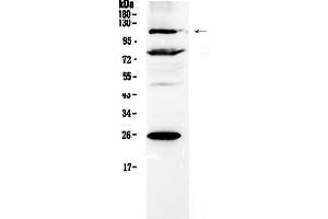 Western blot analysis of NFAT4 using anti-NFAT4 antibody . (NFATC3 抗体  (AA 630-712))