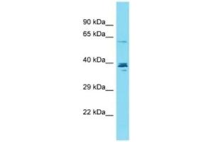 Host: Rabbit , Target: CCDC149,  Sample Type: OVCAR-3 Whole Cell Lysates,  Antibody Dilution: 1. (CCDC149 抗体  (C-Term))