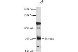 Western blot analysis of extracts of Jurkat cells, using ZNF189 antibody (ABIN7271463) at 1:1000 dilution. (ZNF189 抗体  (AA 1-150))