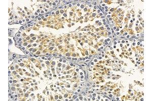 Flt3/CD135 Mouse Monoclonal Antibody at 1/100 staining mouse testis tissue by IHC-P. (FLT3 抗体  (C-Term))