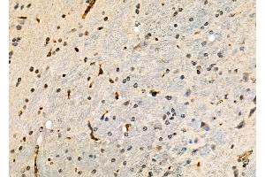 ABIN6264434 and ABIN6277935 at 1/100 staining Mouse brain tissue by IHC-P. (PRMT7 抗体  (Internal Region))