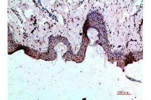 Immunohistochemical analysis of paraffin-embedded human-skin, antibody was diluted at 1:200 (BMP1 抗体  (AA 131-180))