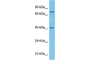 Host:  Rabbit  Target Name:  CPT2  Sample Type:  Ovary Tumor lysates  Antibody Dilution:  1. (CPT2 抗体  (N-Term))