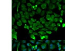 Immunofluorescence analysis of HeLa cells using CUL3 Polyclonal Antibody (Cullin 3 抗体)