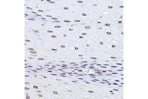 Immunohistochemistry of paraffin-embedded human esophageal using POLR2A Rabbit pAb (ABIN6130298, ABIN6145914, ABIN6145915 and ABIN6215095) at dilution of 1:50 (40x lens). (POLR2A/RPB1 抗体  (AA 1-260))
