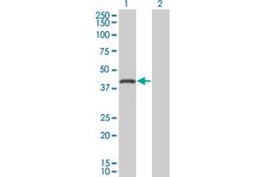 Western Blot analysis of RNF26 expression in transfected 293T cell line by RNF26 monoclonal antibody (M01), clone 5B9. (RNF26 抗体  (AA 344-433))