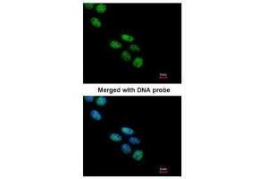 ICC/IF Image Immunofluorescence analysis of paraformaldehyde-fixed A431, using NOVA1, antibody at 1:200 dilution. (NOVA1 抗体  (C-Term))