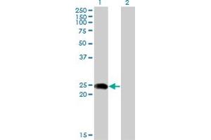 Western Blot analysis of BIN3 expression in transfected 293T cell line by BIN3 monoclonal antibody (M02A), clone 1H8. (BIN3 抗体  (AA 1-199))