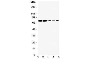 Western blot testing of SGLT1 antibody and Lane 1:  rat kidney (SLC5A1 抗体  (C-Term))