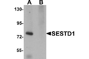 Western Blotting (WB) image for anti-SEC14 and Spectrin Domains 1 (SESTD1) (C-Term) antibody (ABIN1030653) (SESTD1 抗体  (C-Term))