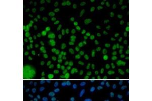 Immunofluorescence analysis of HeLa cells using IRF2 Polyclonal Antibody (IRF2 抗体)