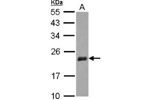NUDT3 抗体  (AA 1-172)