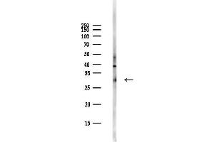 Western blot analysis of lysates from PC12 cells(starvation,24h treatment), using Calretinin Antibody at 1/1000 dilution.
