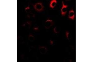 Immunofluorescent analysis of NRAGE staining in A549 cells. (MAGED1 抗体)