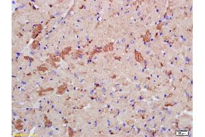 Formalin-fixed and paraffin embedded mouse heart labeled with Rabbit Anti phospho-LATS2 (Ser83) Polyclonal Antibody, Unconjugated (ABIN753568) at 1:200 followed by conjugation to the secondary antibody and DAB staining (LATS2 抗体  (pSer83))