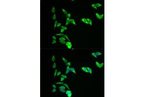 Immunofluorescence analysis of A549 cell using AK1 antibody. (Adenylate Kinase 1 抗体  (AA 1-194))