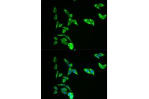 Immunofluorescence analysis of A549 cell using AK1 antibody. (Adenylate Kinase 1 抗体  (AA 1-194))