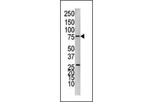 Western Blotting (WB) image for anti-Protein tyrosine Phosphatase, Non-Receptor Type 1 (PTPN1) (AA 23-53), (N-Term) antibody (ABIN1882122)