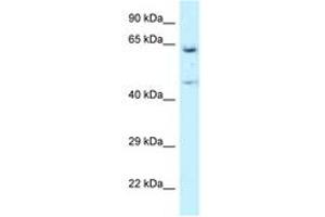Image no. 1 for anti-Asparaginyl-tRNA Synthetase (NARS) (AA 43-92) antibody (ABIN6747536) (NARS 抗体  (AA 43-92))