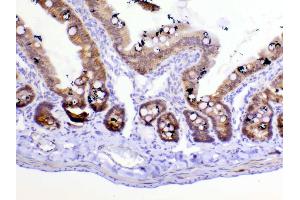 Immunohistochemistry (IHC) image for anti-Catenin (Cadherin-Associated Protein), beta 1, 88kDa (CTNNB1) (AA 2-233) antibody (ABIN5518980)