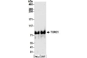 Western Blotting (WB) image for anti-CREB Regulated Transcription Coactivator 1 (CRTC1) (C-Term) antibody (ABIN7453901) (CRTC1 抗体  (C-Term))