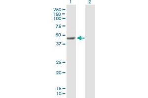 Western Blot analysis of FOXP3 expression in transfected 293T cell line by FOXP3 MaxPab polyclonal antibody. (FOXP3 抗体  (AA 1-431))