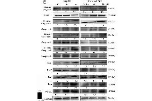 Erianin induced mitochondrial apoptosis in liver cancer cells. (BIM 抗体  (AA 51-150))