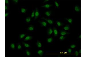 Immunofluorescence of monoclonal antibody to CLK3 on HeLa cell. (CLK3 抗体  (AA 36-136))