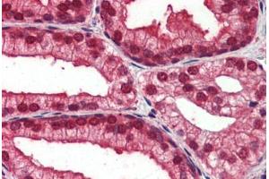 Human Prostate (formalin-fixed, paraffin-embedded) stained with NOTCH4 antibody ABIN462184 followed by biotinylated goat anti-rabbit IgG secondary antibody ABIN481713, alkaline phosphatase-streptavidin and chromogen. (NOTCH4 抗体  (AA 371-420))