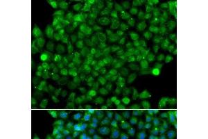 Immunofluorescence analysis of A549 cells using CFHR3 Polyclonal Antibody (CFHR3 抗体)