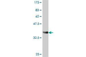 Western Blotting (WB) image for anti-ADAM Metallopeptidase with Thrombospondin Type 1 Motif, 7 (ADAMTS7) (AA 1589-1686) antibody (ABIN564853)