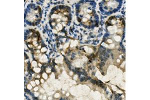 IHC analysis of FABP6 using anti-FABP6 antibody (ABIN7598974). (FABP6 抗体  (AA 1-128))