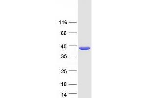 Validation with Western Blot (BCAT2 Protein (Myc-DYKDDDDK Tag))