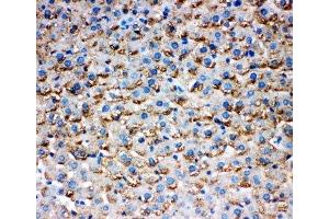 IHC-P testing of rat liver tissue (HSD17B1 抗体  (AA 29-43))
