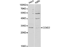 Western Blotting (WB) image for anti-Cyclin D2 (CCND2) antibody (ABIN1875413) (Cyclin D2 抗体)
