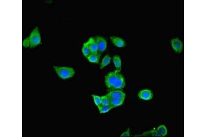 Immunofluorescent analysis of PC-3 cells using ABIN7166896 at dilution of 1:100 and Alexa Fluor 488-congugated AffiniPure Goat Anti-Rabbit IgG(H+L) (PDHA1 抗体  (AA 223-390))