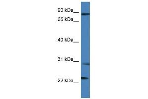 Western Blot showing MIA2 antibody used at a concentration of 1 ug/ml against THP-1 Cell Lysate
