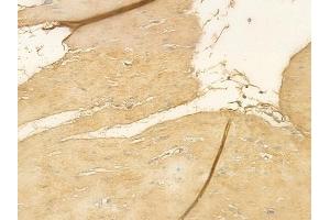ABIN6261119 and ABIN6276682 at 1/100 staining human normal gastric tissue by IHC-P.