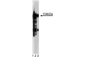 Western blot analysis of Intergrin beta3 on a human platelet lysate. (Integrin beta 3 抗体  (AA 592-712))