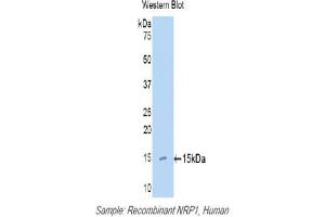 Western blot analysis of the recombinant protein. (Neuropilin 1 抗体  (AA 27-143))