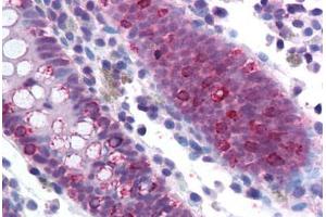 Human Colon (formalin-fixed, paraffin-embedded) stained with SF1 antibody ABIN214143 at 5 ug/ml followed by biotinylated goat anti-rabbit IgG secondary antibody ABIN481713, alkaline phosphatase-streptavidin and chromogen. (Splicing Factor 1 抗体  (AA 517-566))