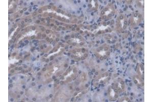 DAB staining on IHC-P; Samples: Rat Kidney Tissue (A4GALT 抗体  (AA 23-288))