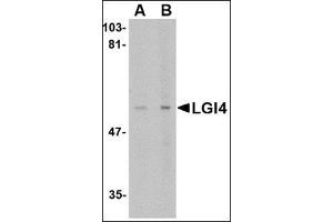 Western blot analysis of LGI4 in rat brain tissue lysate with this product at (A) 1 and (B) 2 μg/ml.
