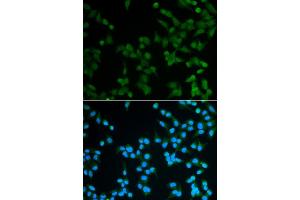 Immunofluorescence analysis of A549 cell using SPIN1 antibody. (Spindlin 1 抗体)