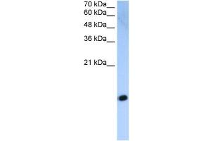 HIST2H2AC antibody used at 2. (HIST2H2AC 抗体  (Middle Region))