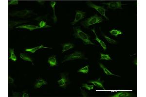 Immunofluorescence of monoclonal antibody to PCBP2 on HeLa cell. (PCBP2 抗体  (AA 1-362))