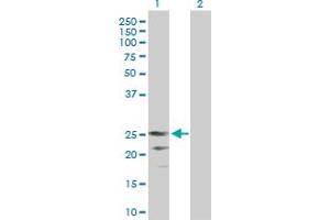 Western Blot analysis of CD70 expression in transfected 293T cell line by CD70 MaxPab polyclonal antibody. (CD70 抗体  (AA 1-193))