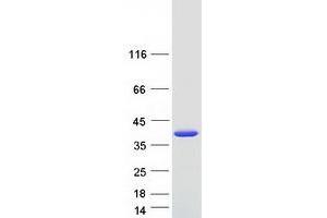 Western Blotting (WB) image for Sulfotransferase Family 1E Member 1 (SULT1E1) protein (Myc-DYKDDDDK Tag) (ABIN2732961)