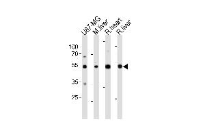 GPT Antibody (N-term ) (ABIN391679 and ABIN2841588) western blot analysis in U87-MG cell line , mouse liver ,and rat heart and liver tissue lysates (35 μg/lane). (ALT 抗体  (N-Term))